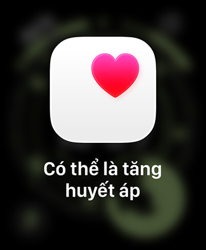 Apple Watch Ultra 3, titanium case, natural color, possible hypertension notification, pink heart in white box, band, Trail Loop, blue/bright blue color